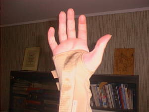 Hand with strap-on support