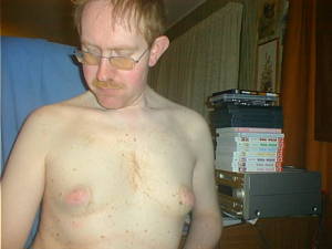 Ugly man with small breasts